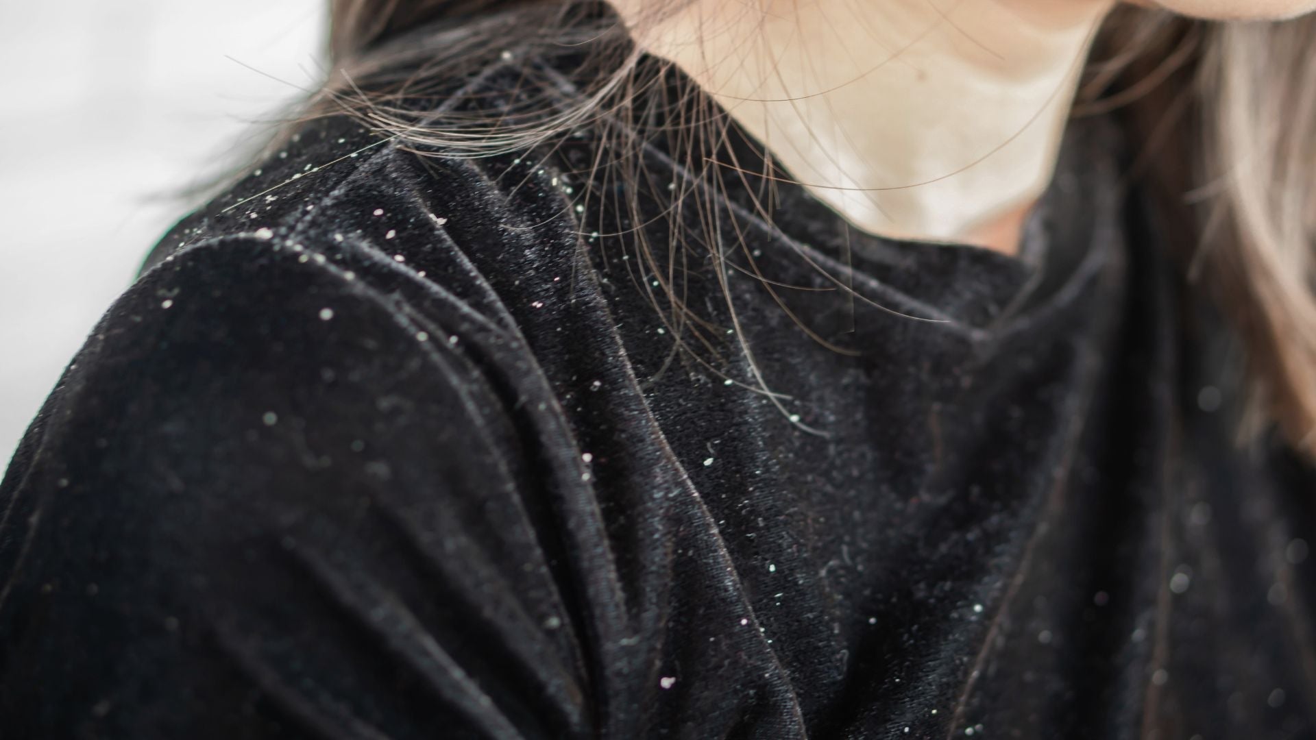 Activos anticaspa más eficaces para combatir la caspa seca y grasa