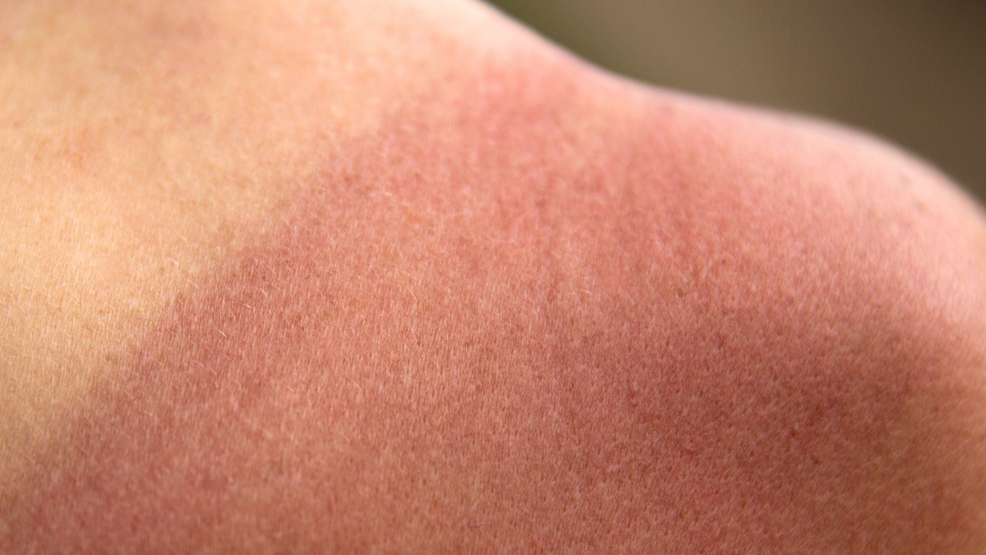 errores autobronceador
