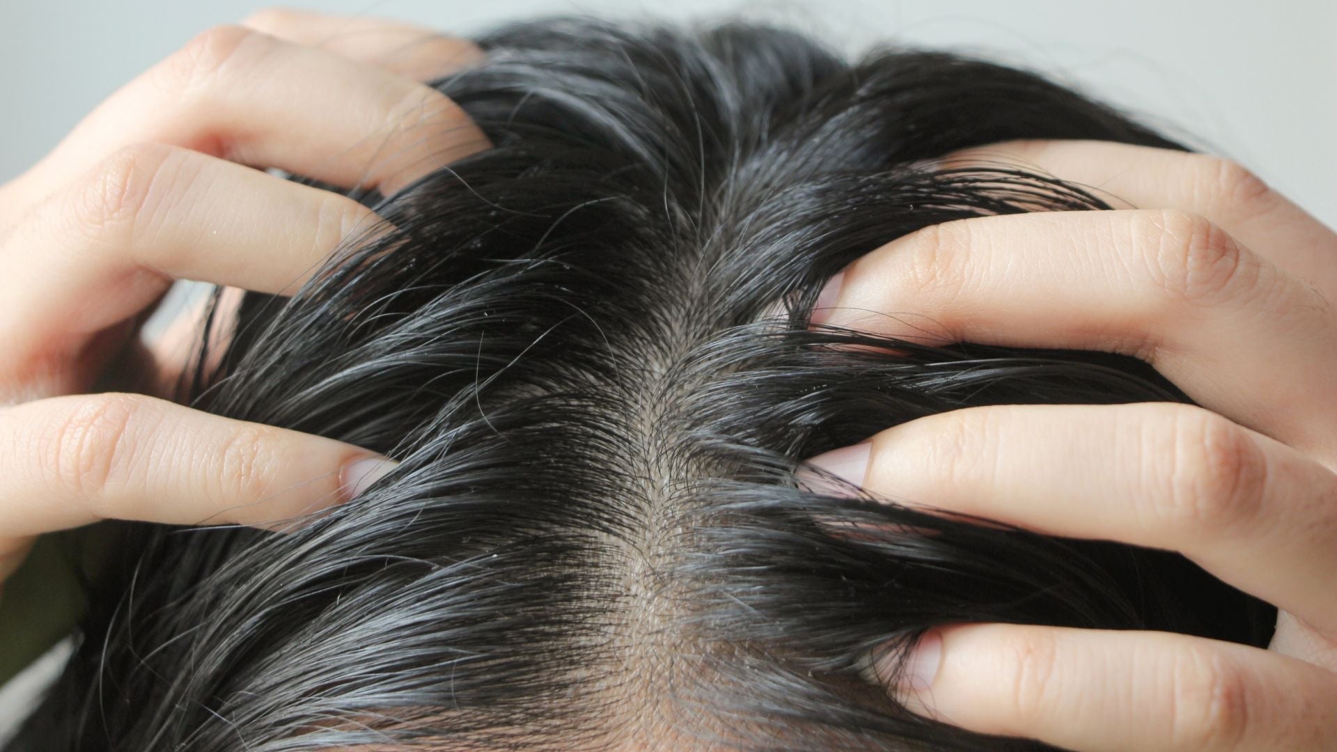 como exfoliar cuero cabelludo