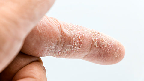 manteca de karite piel seca