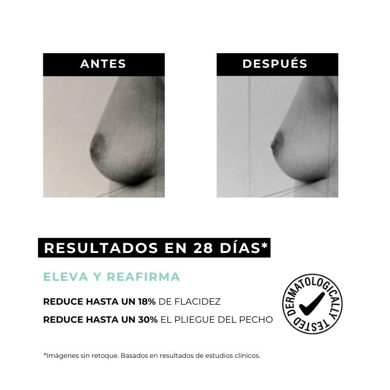 tratamiento reafirmante corporal sin cirugia arganour