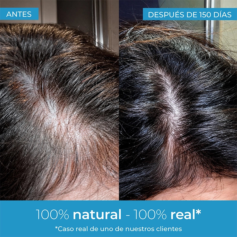 resultados locion anticaida antes y despues arganour