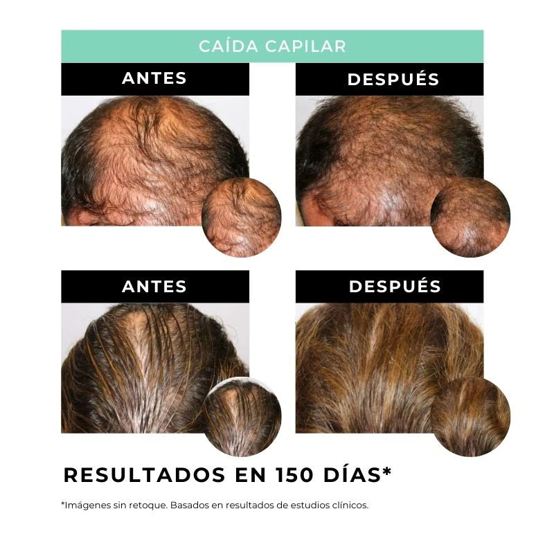Sérum fortalecedor del cabello natural – ARGANOUR