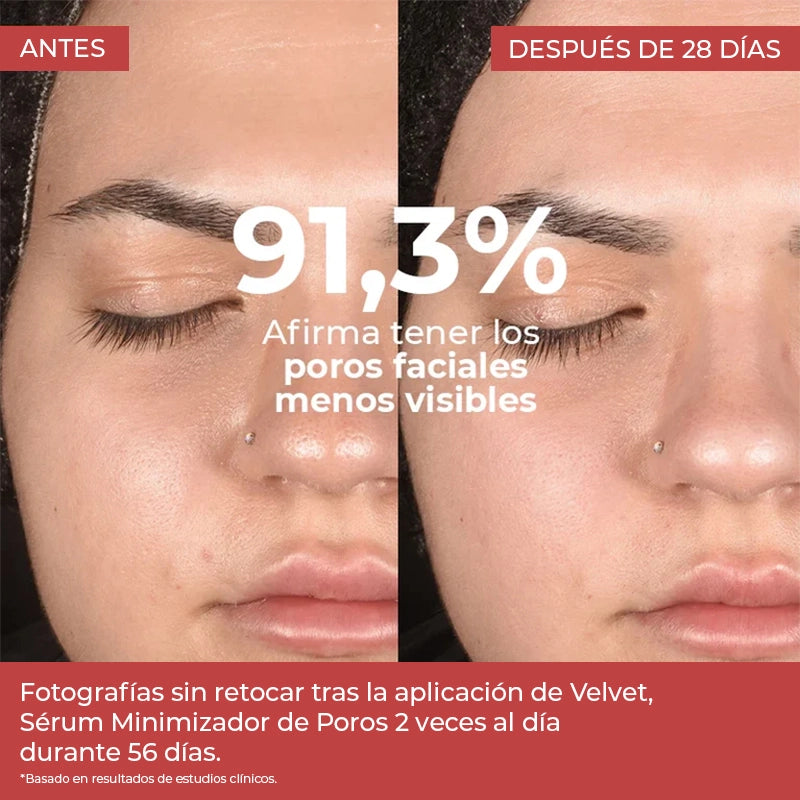 serum para poros abiertos y dilatados