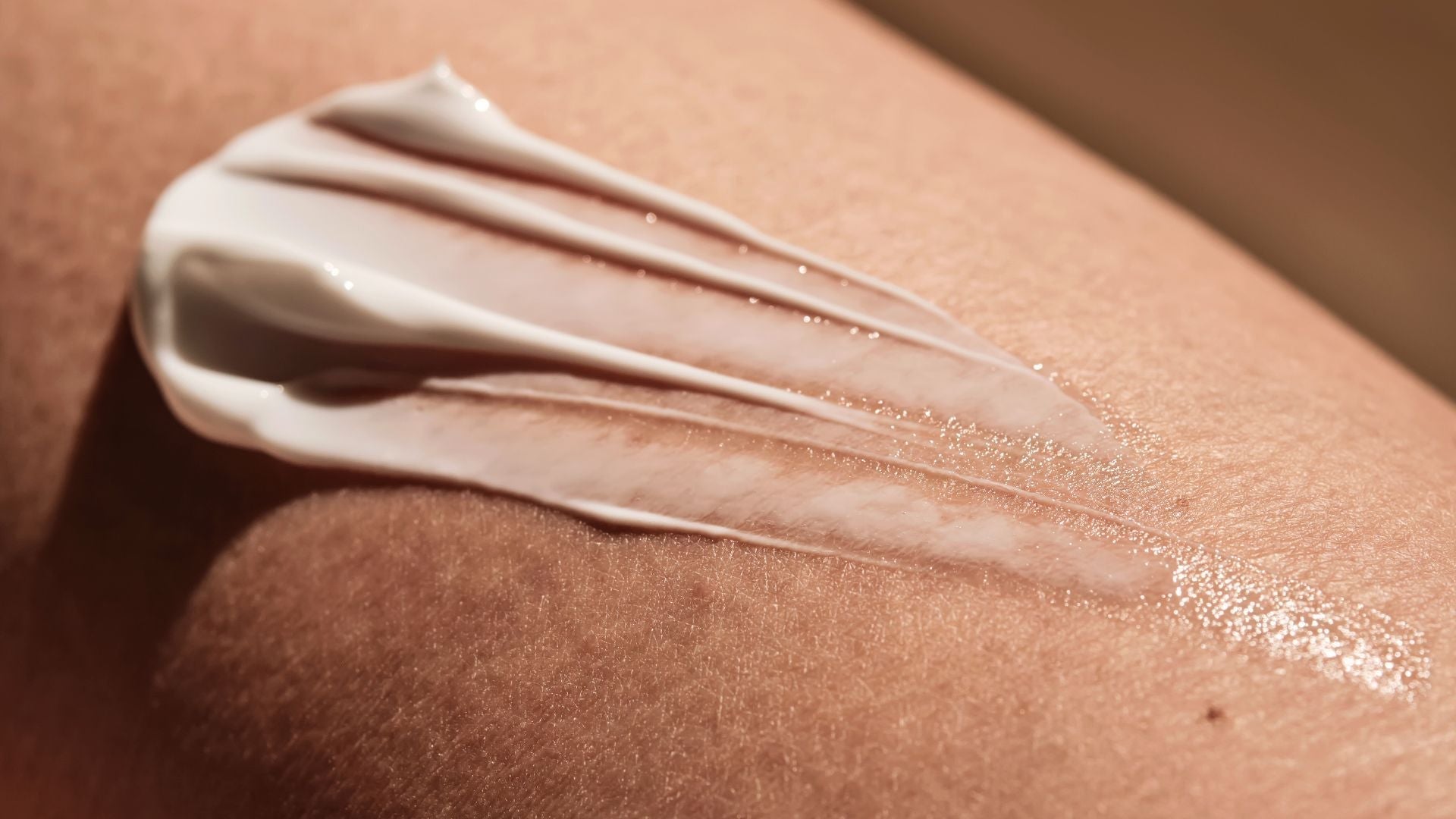 eficacia crema antiestrias