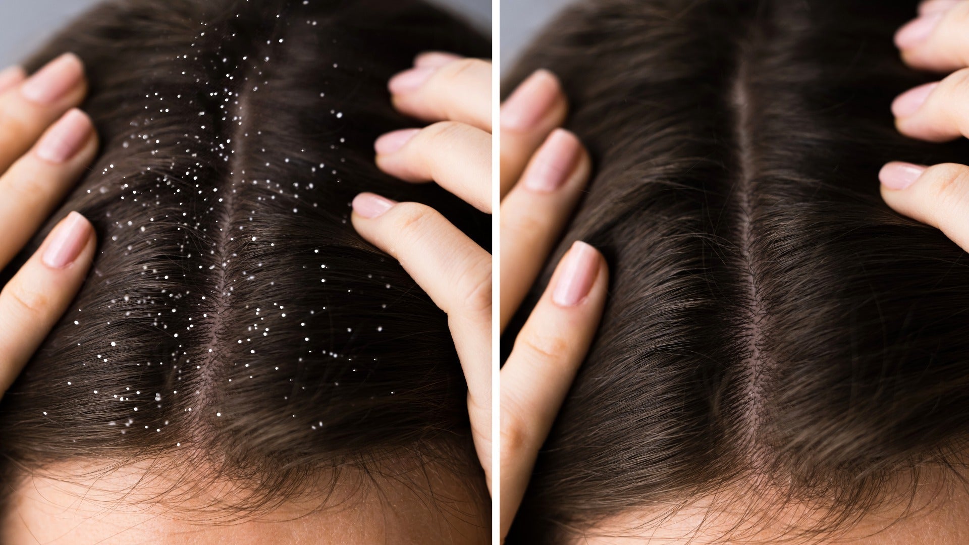 exfoliante cuero cabelludo