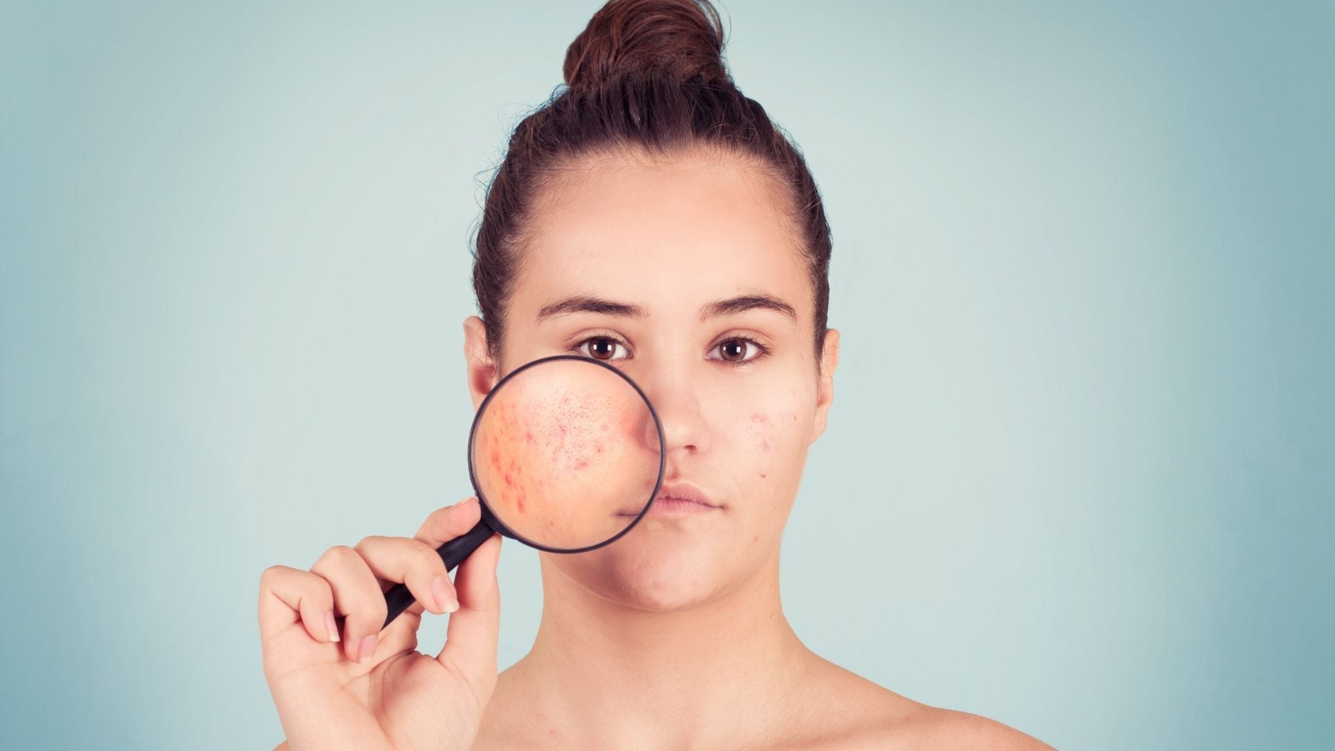 cuidado facial en adolescentes