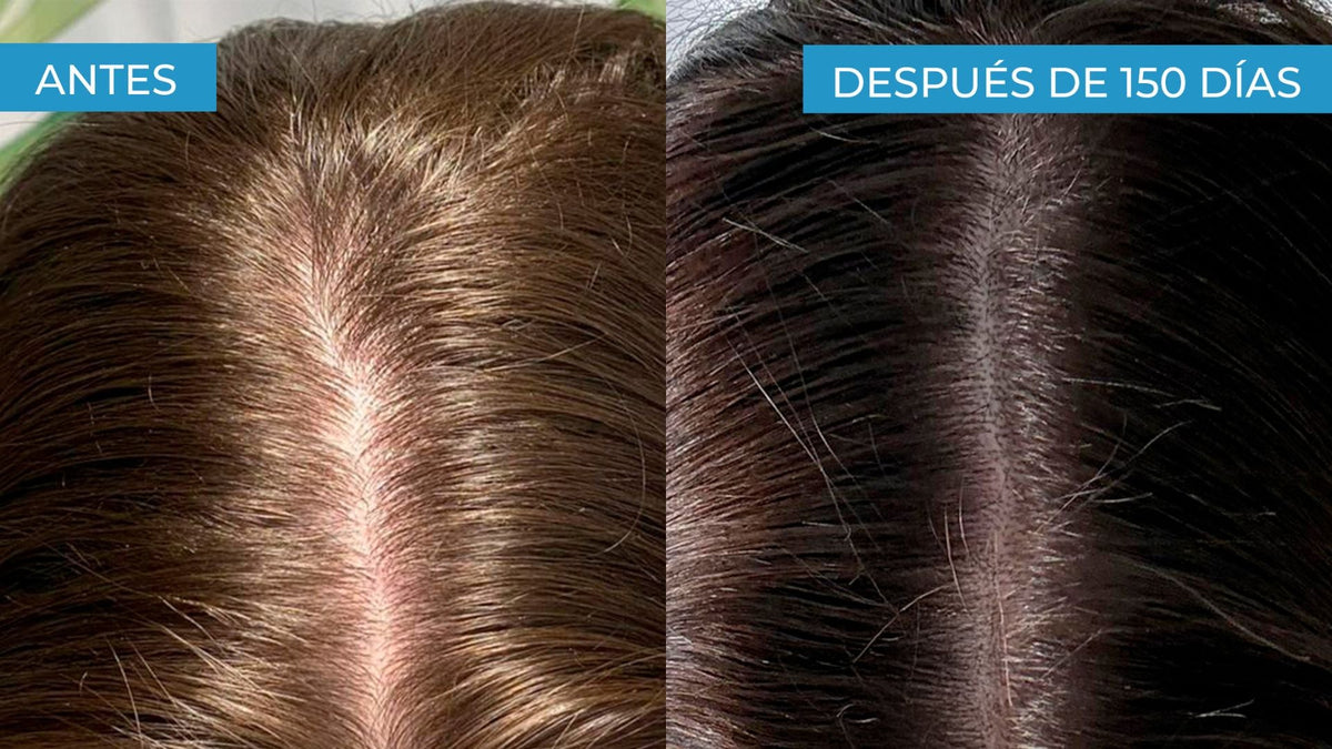 caida capilar menopausia