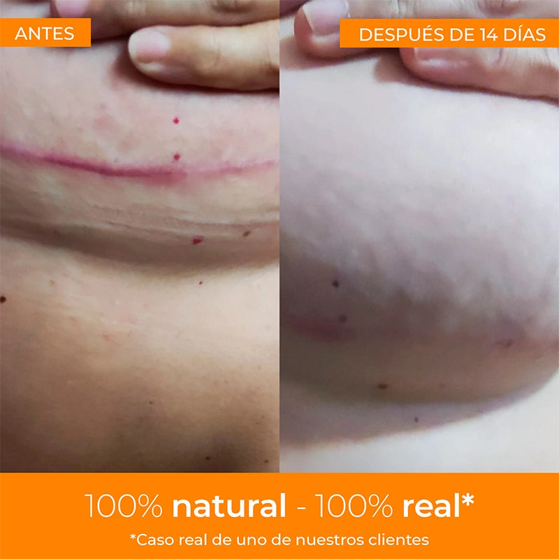 Boticream Crema Reparadora