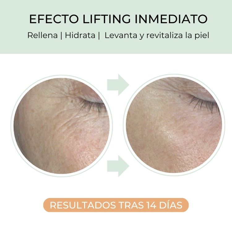 contorno ojos