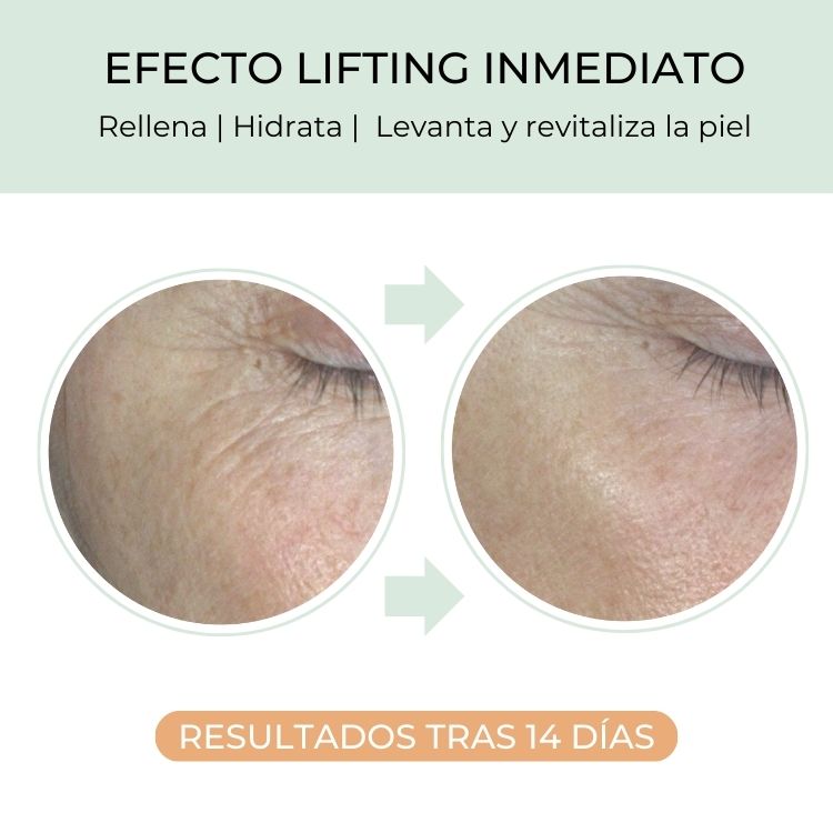 contorno de ojos antiarrugas